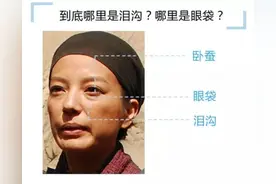 泪痕沟的形成原因及解决方法图片