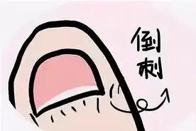 知名女演员因拔倒刺住院动手术！医生：严重可致截肢……图片