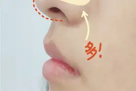 反向去黑头，草莓鼻终于干净了图片