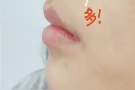 反向去黑头，草莓鼻终于干净了图片