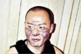 曾被重度烧伤的陈志朋，如今涅槃重生，却被金星吐槽油腻图片