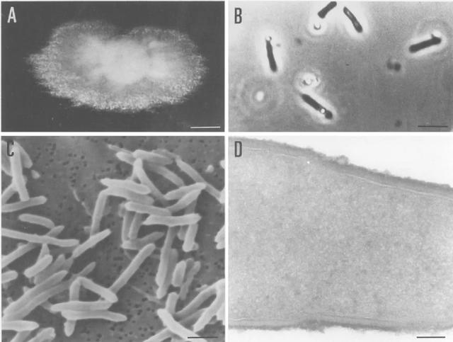 中国首钢用尾气合成蛋白质，全球首次的技术为啥还被喷了？