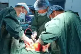 市精神卫生中心“拆弹部队”成功拆除一例巨大腹膜后脂肪肉瘤图片