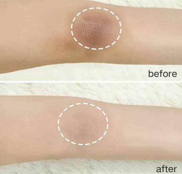 夏天要用身体乳的好处