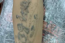 洗文身到底能不能洗干净？图片