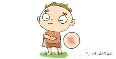 鸡皮疙瘩一块一块红肿