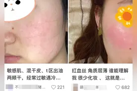 90%的皮肤问题是「作」出来的，快来看看你中招了没？图片