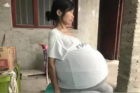 女子两年前开始腹胀，如今肚大如“巨球”，求助社会伸援手图片