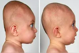 睡姿不当会导致新生儿头骨变形，不少新手妈妈还不懂，及时纠正图片