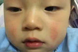 孩子出现“2青2臭”，是娃脾虚的“暗号”，快用4个方法消积食图片