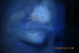 为什么不提倡白癜风病人喝酒？图片