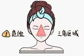 挤痘痘挤出生命危险，真的吗？图片