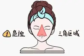 挤痘痘挤出生命危险，真的吗？图片