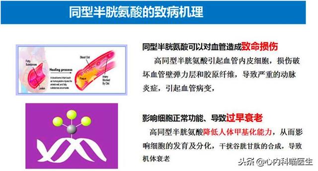 伴有同型半胱氨酸升高的高血压人士，补充“叶酸”，减少脑梗发生