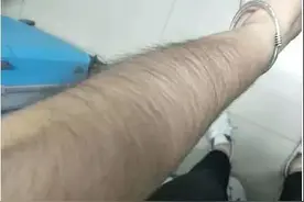 为啥有些女生体毛比男生还多？难道是疾病征兆？妇科专家教您判断图片