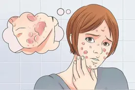 15岁男孩头脸和脖子都长“痘”，还化脓、疼痛！医生一看：不是青春痘，而是毛囊炎图片