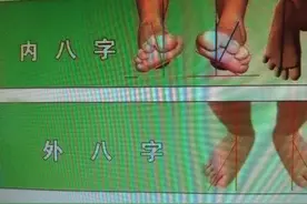 这几种鞋，千万不要给孩子穿，会造成足部伤害图片