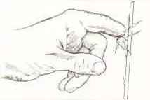 糖尿病周围神经病全知道图片