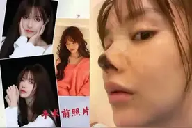 女艺人整容变毁容：到底长得漂亮重要还是活得漂亮重要图片