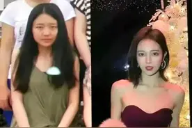 网红项思醒的十年整容之路！以前的是丑小鸭，素颜照最多打3分图片