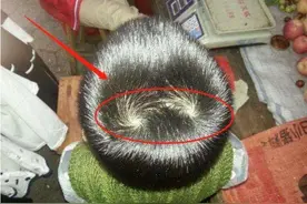 宝宝头顶上“旋”的个数，暗示了孩子智商的高低？父母要了解真相图片