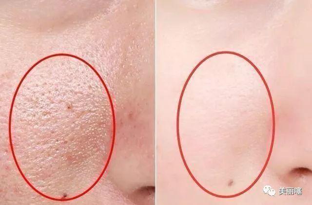 人参维生素e乳可以当身体乳吗