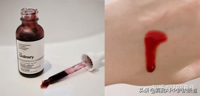 面颊表皮角化