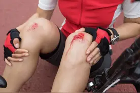 碘伏、酒精、红药水，哪种消毒剂处理外伤更好？图片