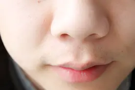 鼻毛“窜”出来，原因在哪里？长得过长，说明了什么问题？图片