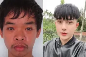 失业丑男9次整容撞脸张东健，大方晒整容前丑照，人生意外改变图片
