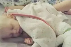 每天喝牛奶，2岁幼儿肠道出血，医生：这类孩子喝牛奶要慎重图片