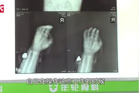 惊险！男童右手伸进搅拌机手指被绞断，家人紧急送医再植视频封面