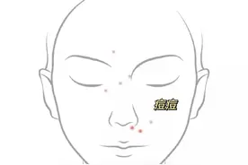 痘痘闭口跑光光！祛痘竟然这么简单图片
