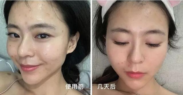 洗面奶中这2种网红护肤成分叠加使用：温和清洁+除螨杀菌＞2？