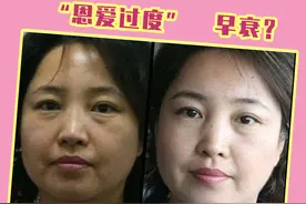 少妇特显老：肌肤松弛、法令纹、眼皮下垂居然跟“恩爱过度”有关图片