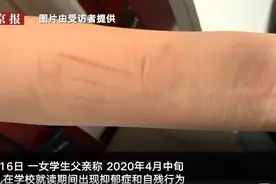 山西运城老师猥亵女学生致其抑郁被批捕，学生出现自残行为图片