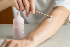 “万能皮肤药”炉甘石洗剂，究竟应该怎么用？7大联用方案请查收图片