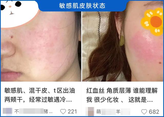 90%的皮肤问题是「作」出来的，快来看看你中招了没？