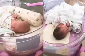 小婴儿出生时的发量，为何会产生差距？家长或许要“问问自己”图片