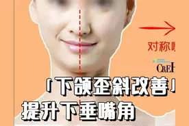 下颌歪斜、嘴角不对称改善，同时提升下垂的嘴角「内附矫正视频」图片