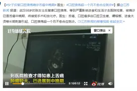 68岁婆婆反复口腔溃疡1月未愈，确诊舌癌晚期，3点预警信号别忽视图片