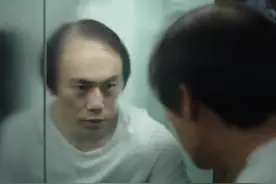 U发小课堂 |“秃”如其来的烦恼！如何自测脱发程度？图片