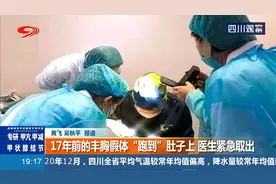 17年前的丰胸假体“跑到”肚子上 医生紧急取出图片