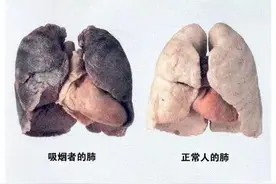 戒烟后，变黑的肺还能再变粉吗？肺功能多久可恢复？男士都该看看图片