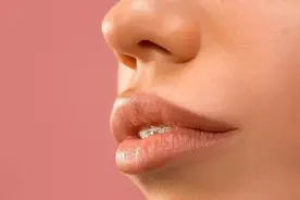 被“嘴突”耽误的美貌，该如何拯救？图片