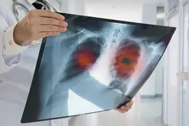 运动让癌细胞扩散得更快吗？医生详细解答！有些癌症病人不宜运动图片