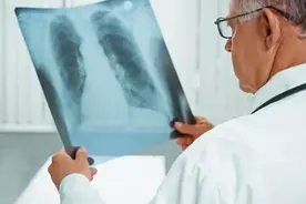 咳嗽一直不好？别只以为是感冒图片