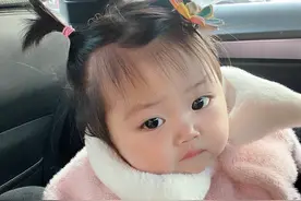 萌娃1岁生日确诊重疾，治疗后变“小黑娃”，妈妈只要她健康就好图片
