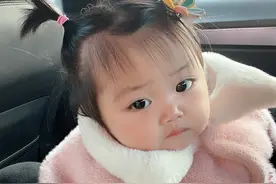 萌娃1岁生日确诊重疾，治疗后变“小黑娃”，妈妈只要她健康就好图片