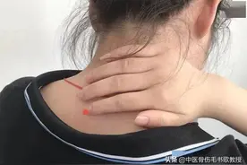 脖子长出“富贵包”，瞬间老10岁！简单3个动作，教你改善富贵包图片